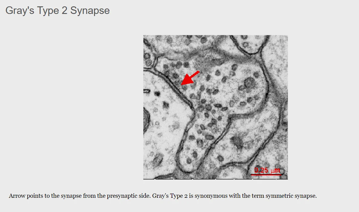 自SynapseWeb：不同的突触类别 Type2