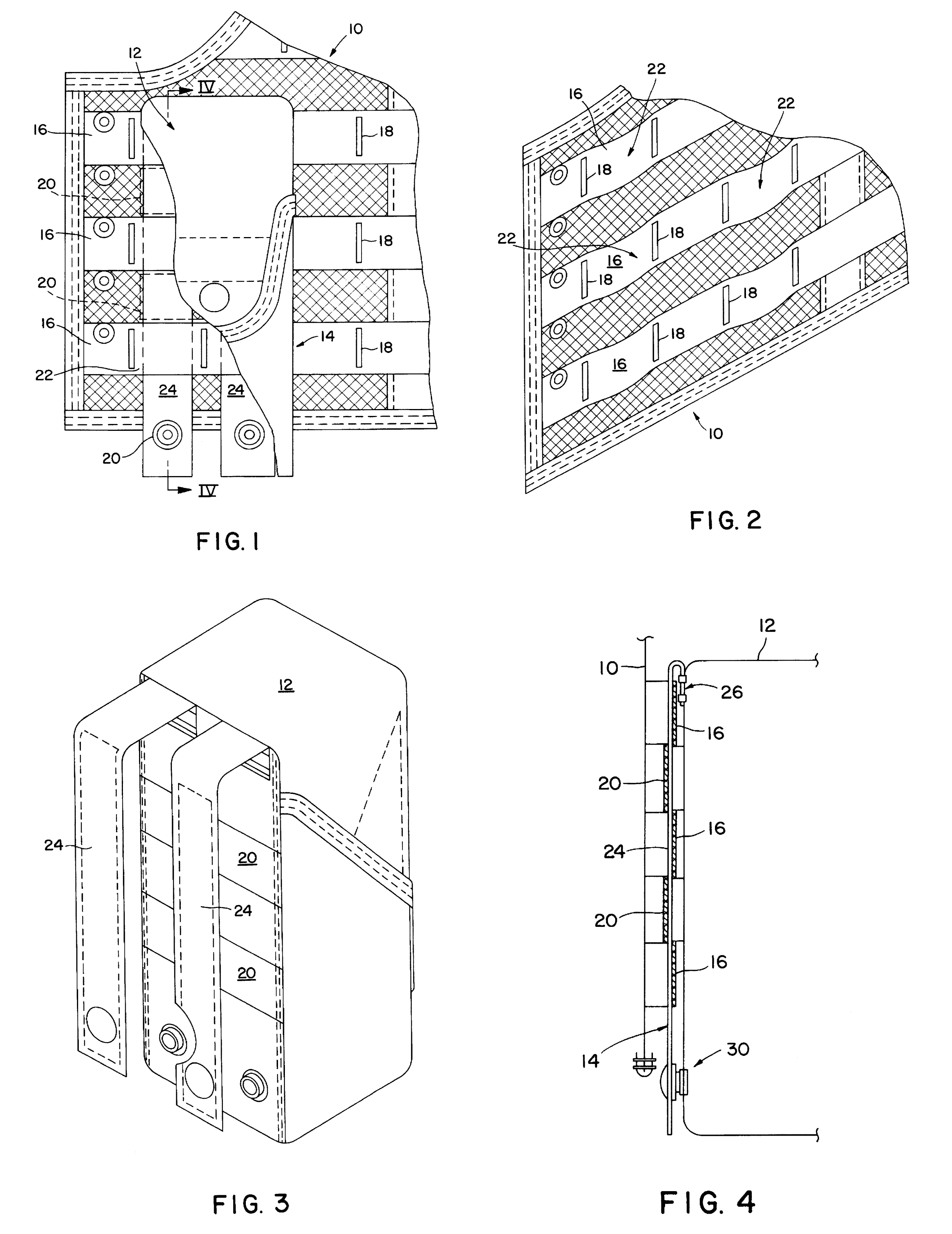 IALS（PALS）专利设计图，专利编号US5724707A