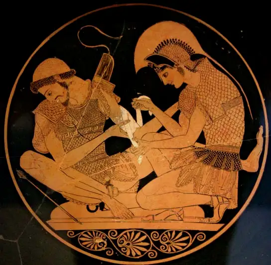 希腊瓶画，图中的阿基里斯穿着的大概就是亚麻甲