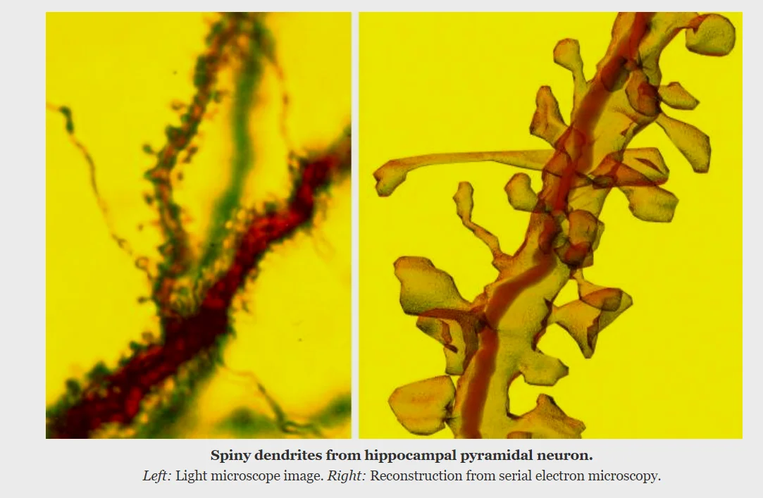 自SynapseWeb：神经元的显微镜/3D重现图片