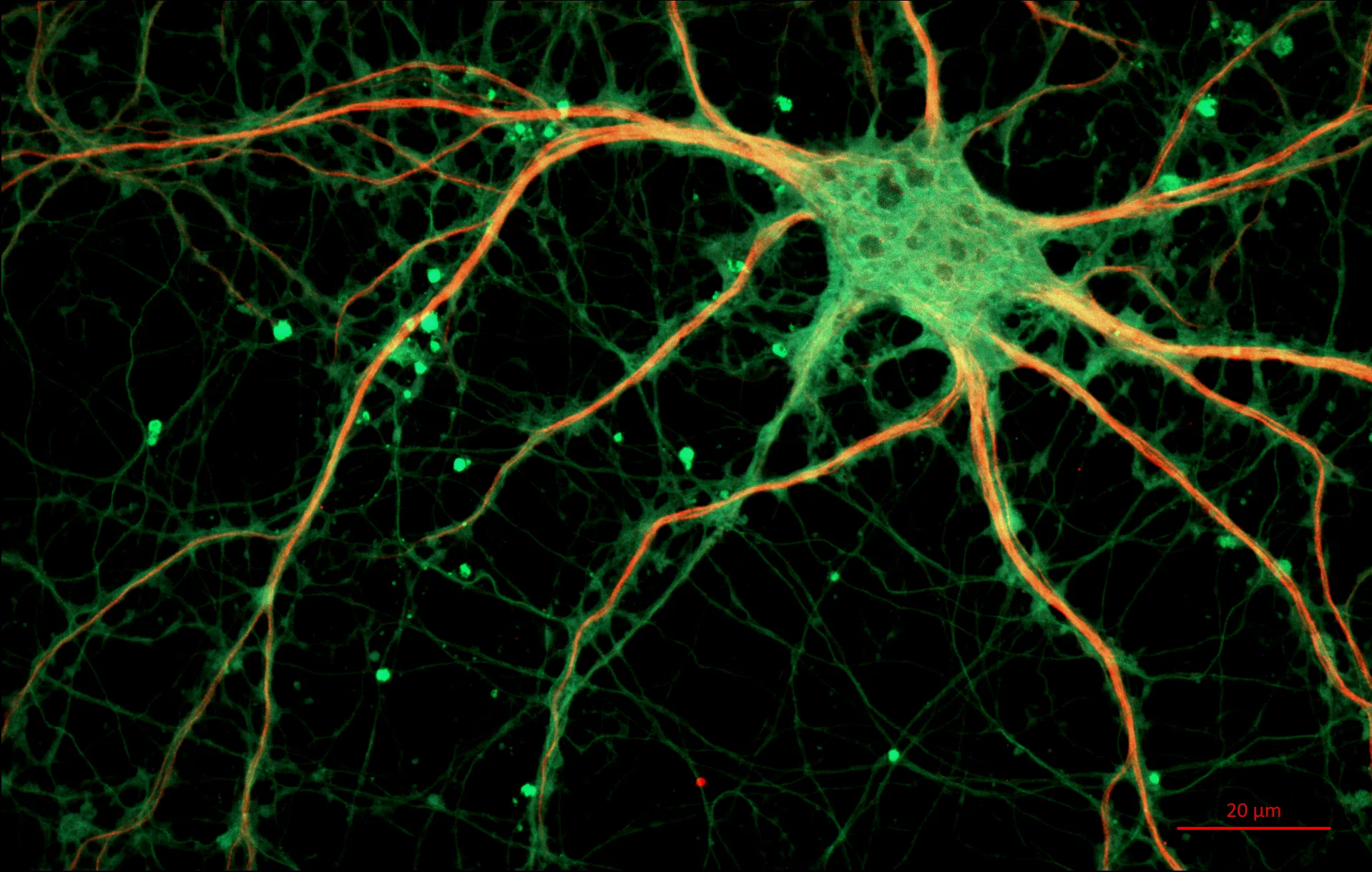 海马体内部的神经元，是动物产生长时间记忆的关键