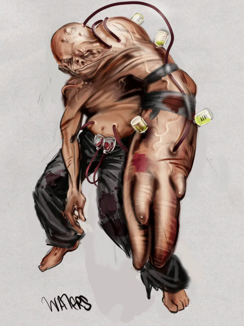 甜手的一个早期版本。作者：罗布·沃特斯
（网址：https://www.reddit.com/r/Bioshock/comments/13flv87/early_concepts_for_splicers_warning_body_horror/）