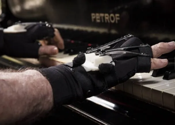 知名钢琴家不幸双手残障，借助仿生手套21年后再度演奏钢琴