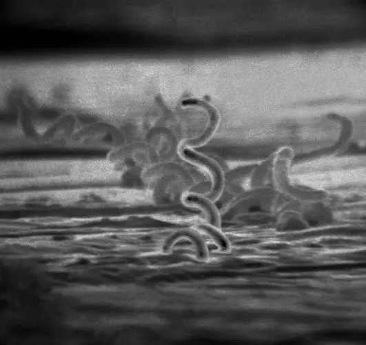 电子显微镜下的梅毒螺旋体