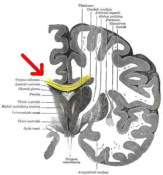 黃色部分為胼胝體（corpus callosum，脳梁）