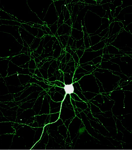 通过荧光染色直接拍摄的神经元，可以看到其不同于一般体细胞的独特结构——大量发散的神经纤维。