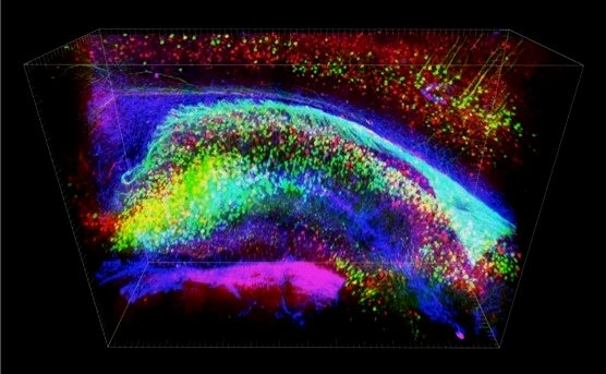 对透明化的大脑进行多重荧光染色，可以建立精度空前的脑神经结构模型。